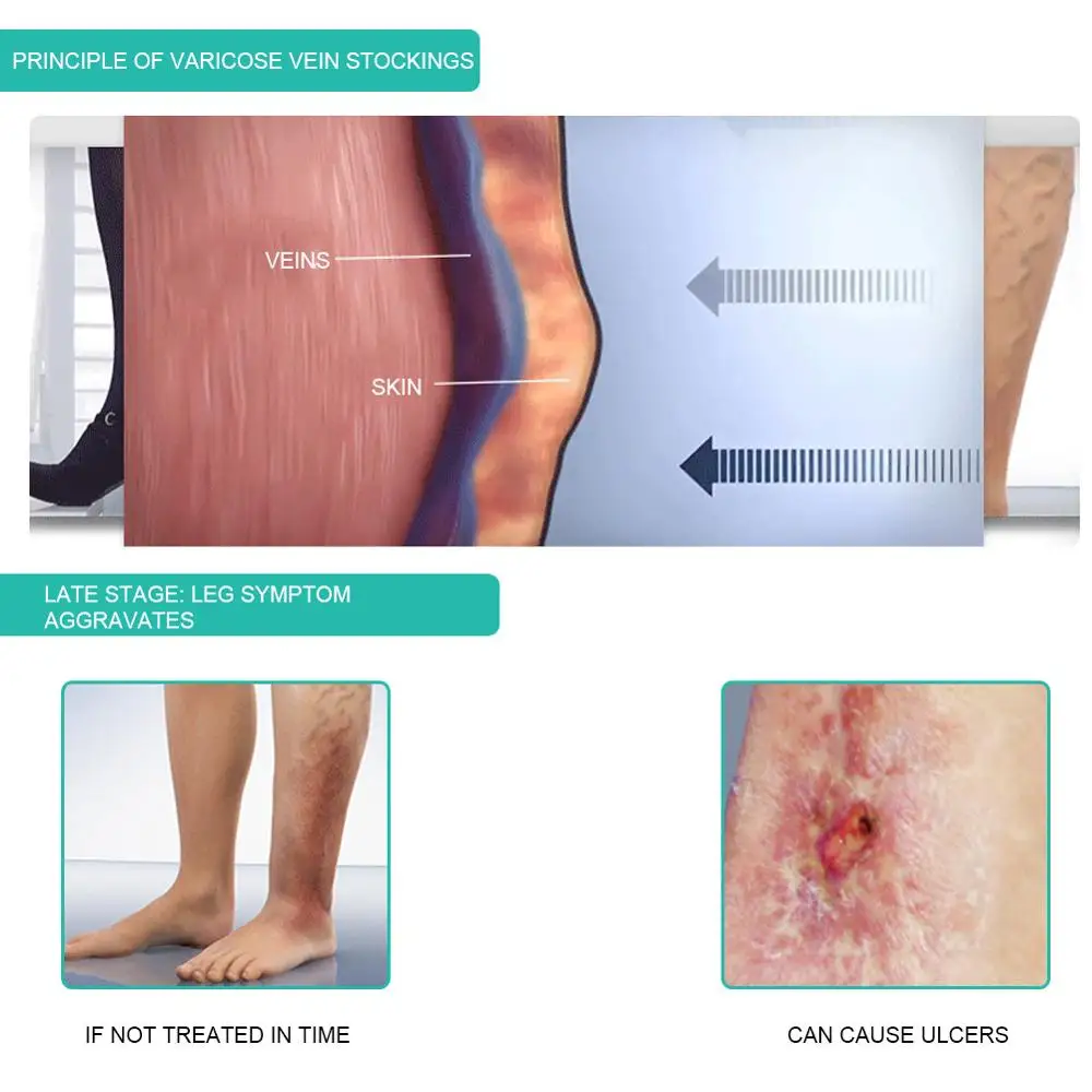 1Pair Medical Compression Sock - Compression Sock Medical ulasan dan harga